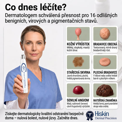 💙💙Oficiální značkový obchod | Hiskin® 7denní odstraňovač skvrn a pigmentových skvrn (Bezbolestný rollerball bez jizev)🐬