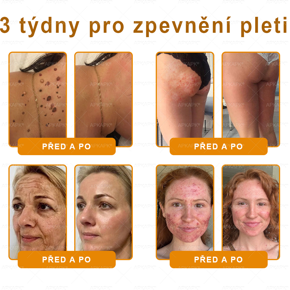 Vyrobeno a odesláno z České republiky 🐝🔥🔥 𝖠𝖯𝖪𝖠𝖯𝖪® Včelí jed Skin Regenerační krém
