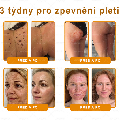 Vyrobeno a odesláno z České republiky 🐝🔥🔥 𝖠𝖯𝖪𝖠𝖯𝖪® Včelí jed Skin Regenerační krém
