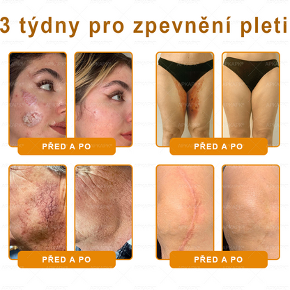 Vyrobeno a odesláno z České republiky 🐝🔥🔥 𝖠𝖯𝖪𝖠𝖯𝖪® Včelí jed Skin Regenerační krém