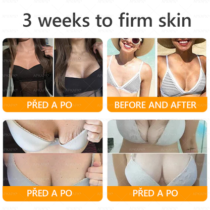 Vyrobeno a odesláno z České republiky 🐝🔥🔥 𝖠𝖯𝖪𝖠𝖯𝖪® Včelí jed Skin Regenerační krém