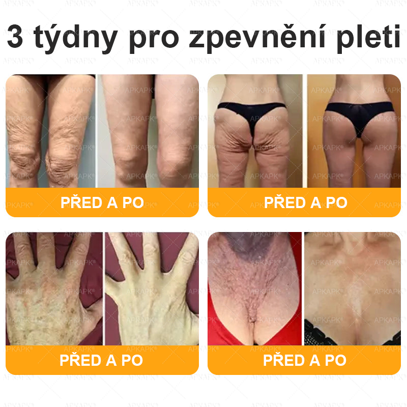 Vyrobeno a odesláno z České republiky 🐝🔥🔥 𝖠𝖯𝖪𝖠𝖯𝖪® Včelí jed Skin Regenerační krém