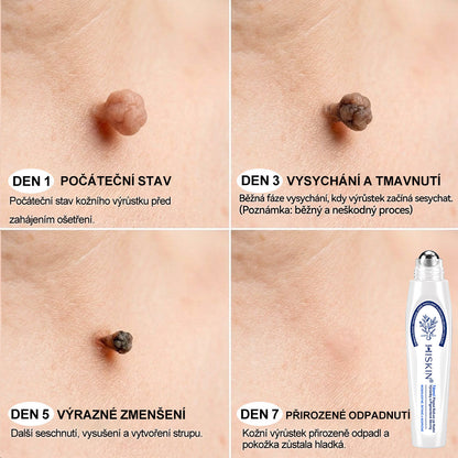 💙💙Oficiální značkový obchod | Hiskin® 7denní odstraňovač skvrn a pigmentových skvrn (Bezbolestný rollerball bez jizev)🐬