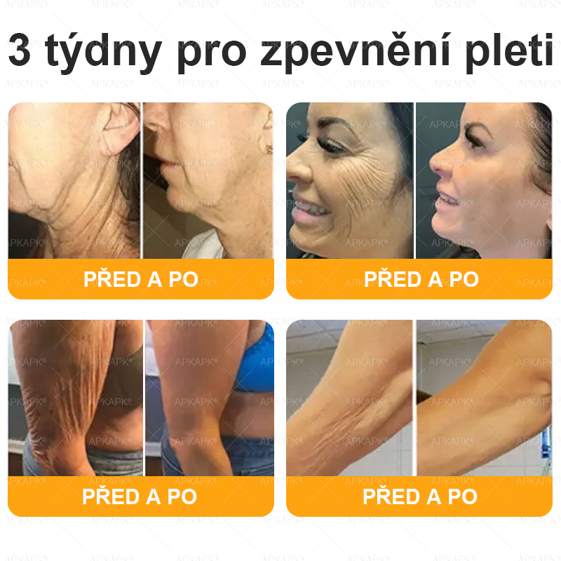Vyrobeno a odesláno z České republiky 🐝🔥🔥 𝖠𝖯𝖪𝖠𝖯𝖪® Včelí jed Skin Regenerační krém
