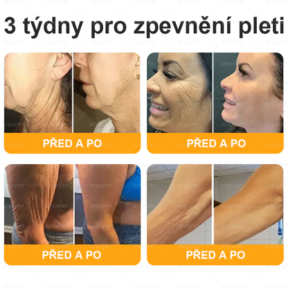 Vyrobeno a odesláno z České republiky 🐝🔥🔥 𝖠𝖯𝖪𝖠𝖯𝖪® Včelí jed Skin Regenerační krém