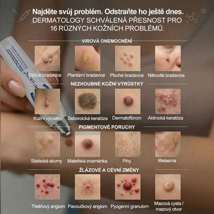 💙💙Oficiální značkový obchod | Hiskin® 7denní odstraňovač skvrn a pigmentových skvrn (Bezbolestný rollerball bez jizev)🐬