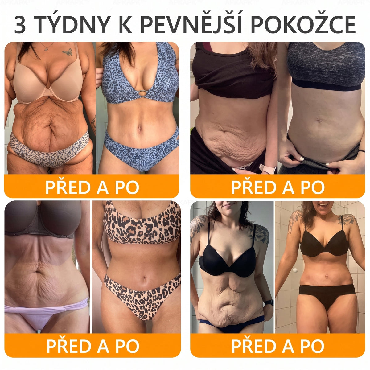 Vyrobeno a odesláno z České republiky 🐝🔥🔥 𝖠𝖯𝖪𝖠𝖯𝖪® Včelí jed Skin Regenerační krém